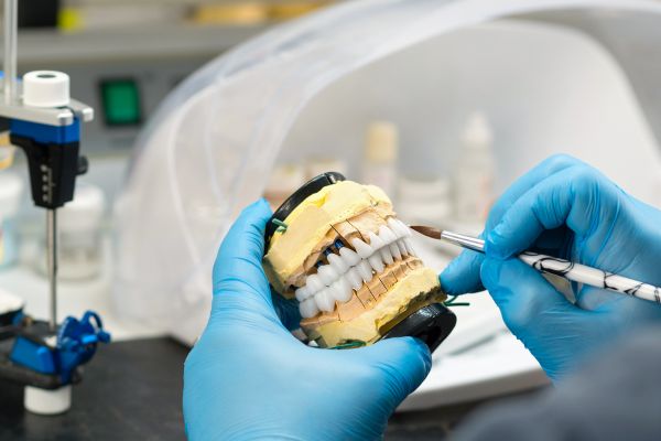 Teeth try-in